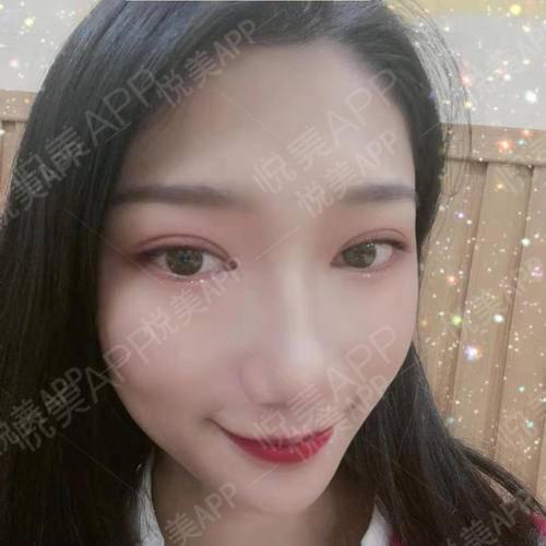 开眼角在线视频,在线视频带你直观了解  第2张